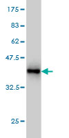 1 - PCDH20 Antibody (monoclonal) (M01) AT3214a