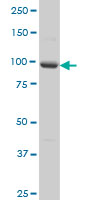 1 - PCDHA5 Antibody (monoclonal) (M01A) AT3219a