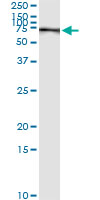 5 - PCK1 Antibody (monoclonal) (M01) AT3233a