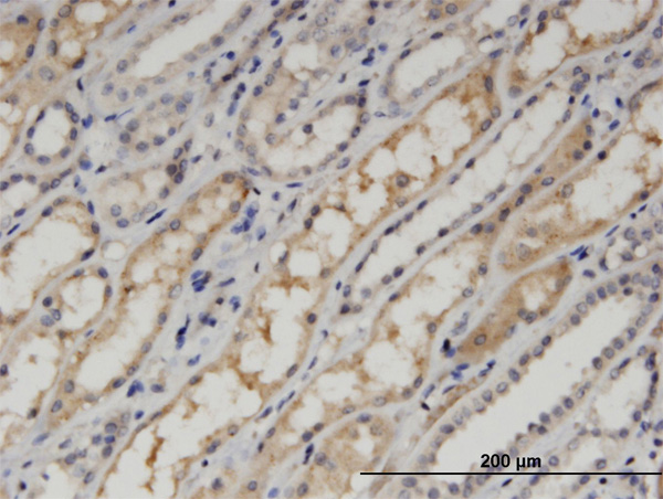 2 - PDLIM1 Antibody (monoclonal) (M02) AT3262a