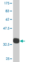 1 - PDLIM1 Antibody (monoclonal) (M02) AT3262a