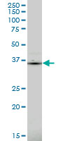 1 - PDLIM1 Antibody (monoclonal) (M02) AT3262a