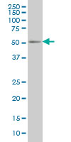 1 - PEPD Antibody (monoclonal) (M01) AT3268a