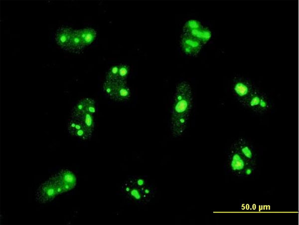 3 - PER2 Antibody (monoclonal) (M01) AT3269a