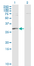 1 - PGAM1 Antibody (monoclonal) (M01) AT3277a