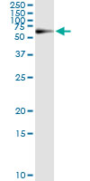 5 - PGM1 Antibody (monoclonal) (M01) AT3282a