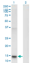 1 - PLA2G1B Antibody (monoclonal) (M14) AT3329a