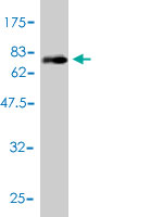 1 - PLTP Antibody (monoclonal) (M01) AT3351a