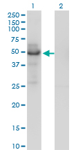 1 - PLTP Antibody (monoclonal) (M01) AT3351a