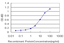 10 - PNLIPRP2 Antibody (monoclonal) (M03) AT3359a