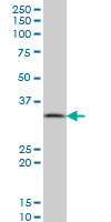 1 - PPA1 Antibody (monoclonal) (M01) AT3391a
