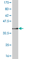 1 - PPARBP Antibody (monoclonal) (M05) AT3392a