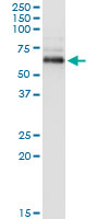 5 - PPM1B Antibody (monoclonal) (M01) AT3406a