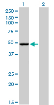1 - PPOX Antibody (monoclonal) (M01) AT3407a