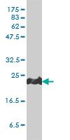 1 - PRDX1 Antibody (monoclonal) (M01) AT3419a