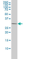 1 - PRKAB2 Antibody (monoclonal) (M01) AT3429a