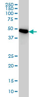 1 - PSMC3 Antibody (monoclonal) (M01) AT3465a