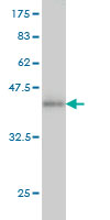 1 - PSME2 Antibody (monoclonal) (M02) AT3475a