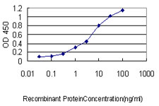 10 - PSPH Antibody (monoclonal) (M02) AT3476a
