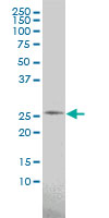 1 - PSPH Antibody (monoclonal) (M02) AT3476a