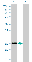 1 - PSPH Antibody (monoclonal) (M02) AT3476a