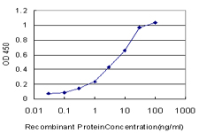 10 - PSPH Antibody (monoclonal) (M06) AT3477a