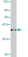 1 - PSPH Antibody (monoclonal) (M06) AT3477a