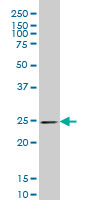 1 - PSPH Antibody (monoclonal) (M06) AT3477a