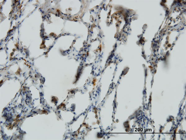2 - PX19 Antibody (monoclonal) (M01) AT3504a