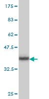 1 - PX19 Antibody (monoclonal) (M01) AT3504a