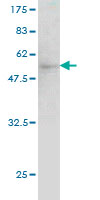 1 - QDPR Antibody (monoclonal) (M02) AT3507a