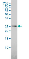 1 - QDPR Antibody (monoclonal) (M02) AT3507a