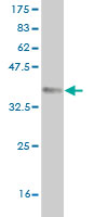 1 - QPCT Antibody (monoclonal) (M01) AT3508a