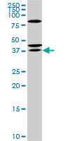 1 - RDHE2 Antibody (monoclonal) (M01) AT3610a
