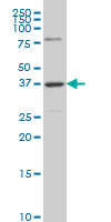 1 - RDHE2 Antibody (monoclonal) (M01) AT3610a