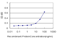 10 - REG1A Antibody (monoclonal) (M16) AT3615a