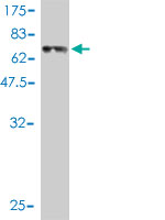 1 - REN Antibody (monoclonal) (M01) AT3617a