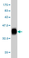1 - RHCG Antibody (monoclonal) (M06) AT3632a