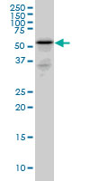 1 - RHCG Antibody (monoclonal) (M06) AT3632a