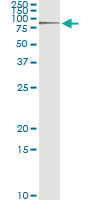 5 - RNF12 Antibody (monoclonal) (M01) AT3658a