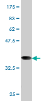 1 - RRM1 Antibody (monoclonal) (M03) AT3729a