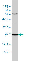 1 - SDF2 Antibody (monoclonal) (M01) AT3801a