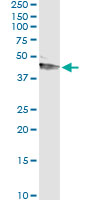5 - SERPINA12 Antibody (monoclonal) (M01) AT3817a
