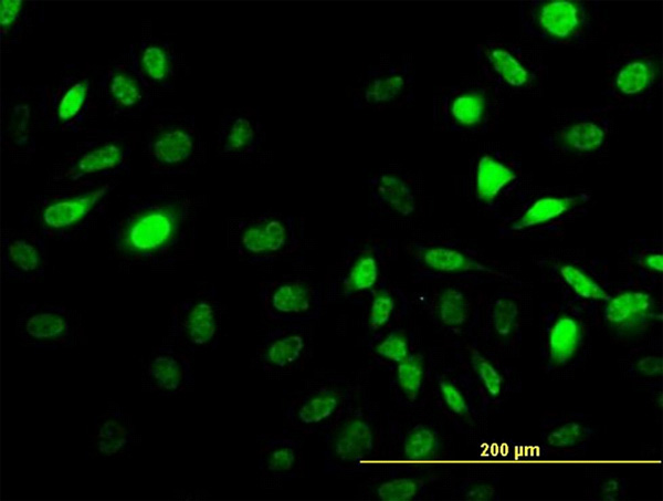 3 - SESN2 Antibody (monoclonal) (M03) AT3830a