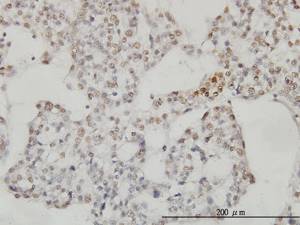 2 - SESN2 Antibody (monoclonal) (M03) AT3830a