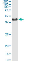 5 - SGTA Antibody (monoclonal) (M06) AT3860a