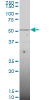 1 - SMAD6 Antibody (monoclonal) (M07) AT3946a