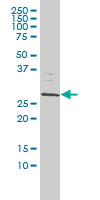 1 - SMNDC1 Antibody (monoclonal) (M01) AT3958a
