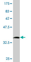 1 - SMPDL3B Antibody (monoclonal) (M01) AT3963a