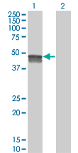 1 - SMPDL3B Antibody (monoclonal) (M01) AT3963a